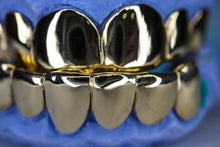 Load image into Gallery viewer, Atown Grillz &quot;Famous 12&quot; 14k Gold Grill
