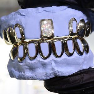 Atown Grillz "Pearl Opal with Gap"