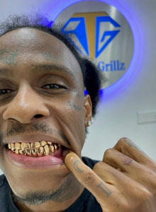 Custom Grillz 22K