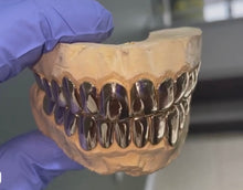 Load image into Gallery viewer, Custom Grillz 14K
