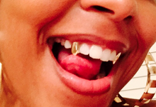 Load image into Gallery viewer, ATown Fang Grillz