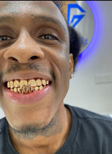 Load image into Gallery viewer, Custom Grillz 22K