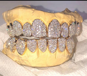 18K (16) VVS Diamond Grillz (PERM CUT)