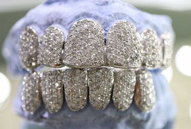 10k High Quality Si Flooded Diamond Grillz