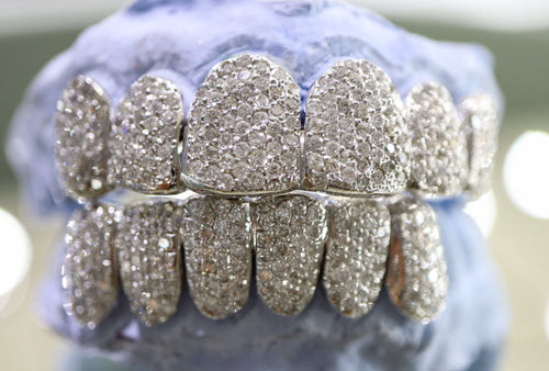 Custom Grillz 14K