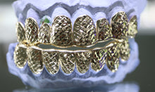 Load image into Gallery viewer, Atown Diamond Cut Grillz