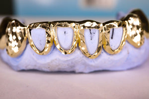 Atown Diamond-Cut Open Face Grillz