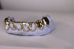 Atown Diamond-Cut Open Face Grillz