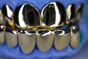 Atown Grillz "Famous 12" 14k Gold Grill