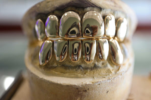 Custom Grillz 14K