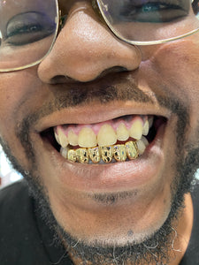 Atown Grillz "Crazy Nugget" Custom Grill