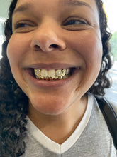 Load image into Gallery viewer, Atown Grillz &quot;SouthSide 10piece&quot; Grill