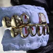 Load image into Gallery viewer, Atown Grillz &quot;Pearl Opal with Gap&quot;
